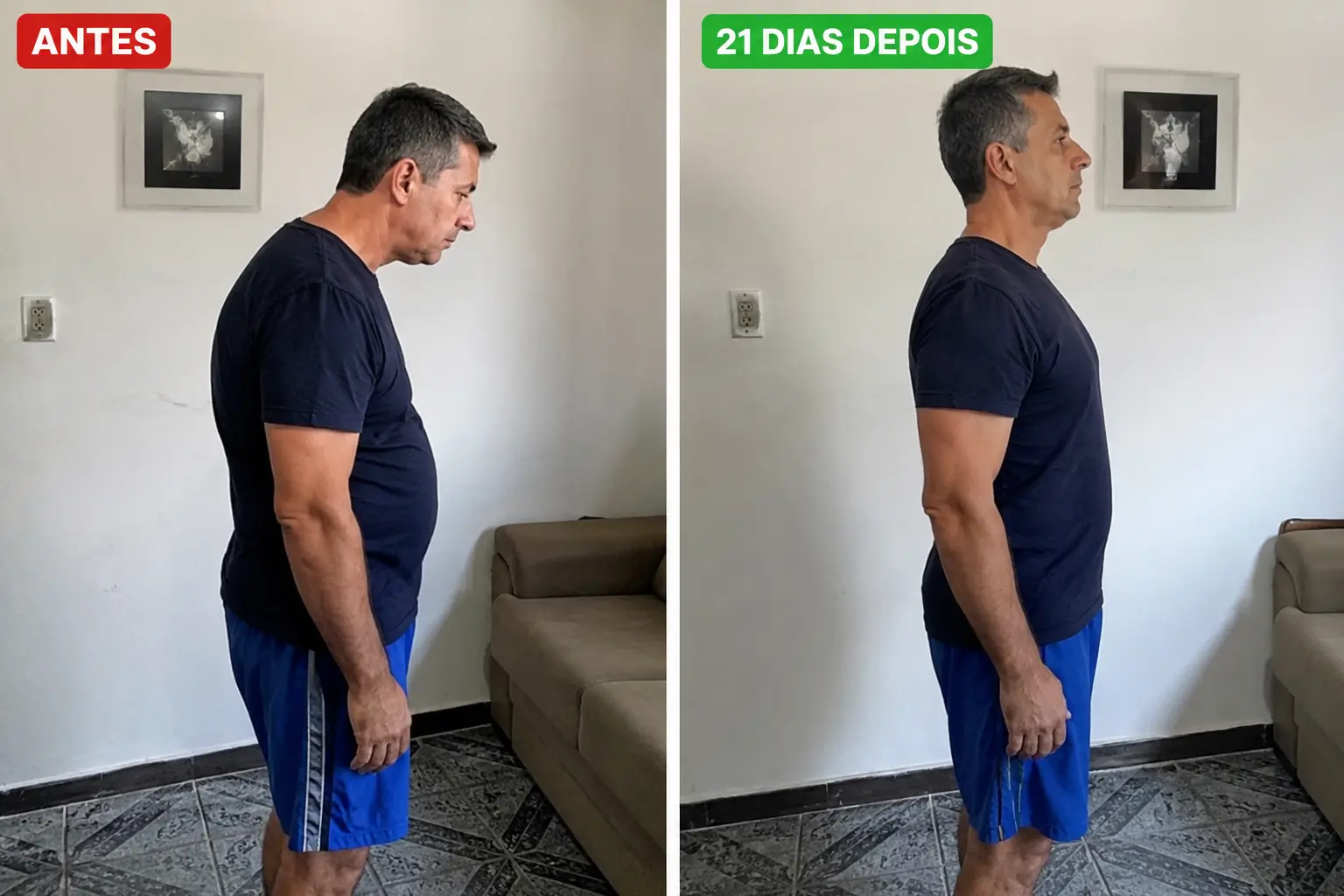 Método Coluna Certa — antes e depois da postura